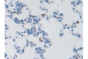 Detection of LRRC32 in Rat Lung Tissue using Polyclonal Antibody to Leucine Rich Repeat Containing Protein 32 (LRRC32) (LRRC32 抗体  (AA 162-405))