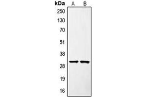Western blot analysis of SURF1 expression in Jurkat (A), mouse liver (B) whole cell lysates.