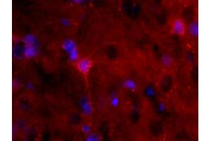 Formalin-fixed and paraffin-embedded rat brain labeled with Anti-S100B Polyclonal Antibody, Unconjugated (ABIN676703) 1:200, overnight at 4°C, The secondary antibody was Goat Anti-Rabbit IgG, PE conjugated used at 1:200 dilution for 40 minutes at 37°C. (S100B 抗体  (AA 31-92))