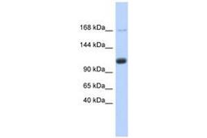Image no. 1 for anti-U2-Associated SR140 Protein (SR140) (AA 755-804) antibody (ABIN6740720) (SR140 抗体  (AA 755-804))
