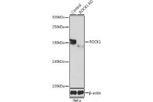 Western blot analysis of extracts from normal (control) and ROCK1 knockout (KO) HeLa cells using ROCK1 Polyclonal Antibody at dilution of 1:1000. (ROCK1 抗体)