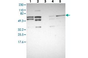 Western blot analysis of Lane 1: RT-4, Lane 2: U-251 MG, Lane 3: Human Plasma, Lane 4: Liver, Lane 5: Tonsil with C14orf133 polyclonal antibody . (VIPAR 抗体)
