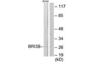 Western blot analysis of extracts from RAW264. (BRI3BP 抗体  (AA 1-50))