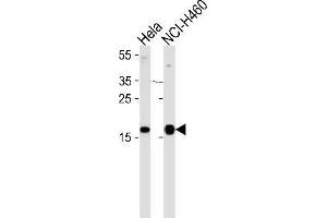 Western blot analysis of NDP kinase A Antibody (C-term) Cat. (NME1 抗体  (C-Term))