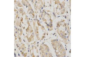 Immunohistochemistry of paraffin-embedded human stomach using STK11 antibody (ABIN5971149) at dilution of 1/200 (40x lens). (LKB1 抗体)