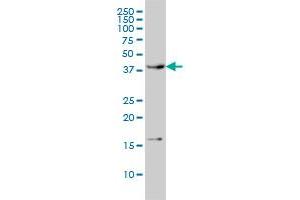 CAMK1 monoclonal antibody (M01), clone 3G1 Western Blot analysis of CAMK1 expression in HL-60 . (CAMK1 抗体  (AA 271-370))