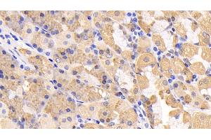 Immunohistochemistry (IHC) image for anti-Protein Kinase, AMP-Activated, alpha 1 Catalytic Subunit (PRKAA1) (AA 28-257) antibody (ABIN7440413)