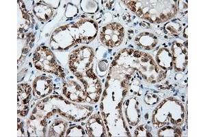 Immunohistochemical staining of paraffin-embedded Kidney tissue using anti-NPR3 mouse monoclonal antibody. (NPR3 抗体)