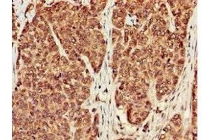 Immunohistochemistry (IHC) image for anti-Protein Phosphatase 1, Catalytic Subunit, beta Isoform (PPP1CB) (AA 175-221), (Catalytic Subunit) antibody (ABIN7169308)