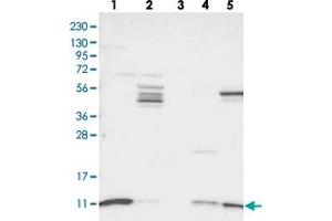 Western blot analysis of Lane 1: RT-4, Lane 2: U-251 MG, Lane 3: Human Plasma, Lane 4: Liver, Lane 5: Tonsil with SH3BGRL3 polyclonal antibody . (SH3BGRL3 抗体)
