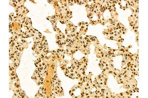 ABIN7094285 and ABIN7098332 at 1/100 staining Rat lung tissue by IHC-P. (HP1BP3 抗体  (Internal Region))