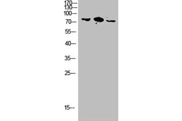 RHOBTB3 抗体  (Internal Region)