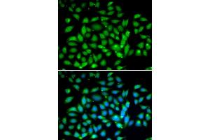 Immunofluorescence analysis of U2OS cells using MECP2 antibody (ABIN6134134, ABIN6143680, ABIN6143682 and ABIN6217279). (MECP2 抗体  (AA 1-100))