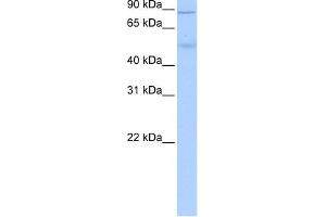 ALDH1L1 antibody used at 0. (ALDH1L1 抗体  (Middle Region))