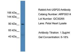 WB Suggested Anti-USP20  Antibody Titration: 0. (USP20 抗体  (Middle Region))