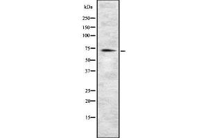Western blot analysis of MIC1 using HeLa whole cell lysates (C18orf8 抗体  (C-Term))