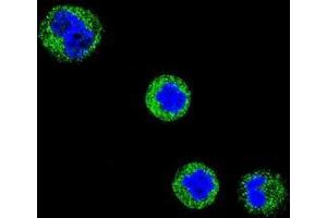 Confocal immunofluorescent analysis of CD1E Antibody (Center)(Cat#AP50840PU-N) with MDA-MB435 cell followed by Alexa Fluor 488-conjugated goat anti-rabbit lgG (green). (CD1e 抗体  (Middle Region))