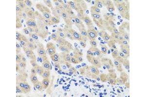 Immunohistochemistry of paraffin-embedded Human liver damage using HSD11B2 Polyclonal Antibody at dilution of 1:100 (40x lens). (HSD11B2 抗体)