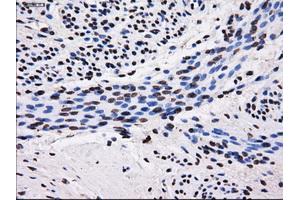 Immunohistochemistry (IHC) image for anti-Sorbitol Dehydrogenase (SORD) antibody (ABIN1501077) (SORD 抗体)