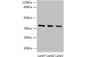 Western blot All lanes: GALE antibody at 2 μg/mL Lane 1: HepG2 whole cell lysate Lane 2: Hela whole cell lysate Lane 3: A549 whole cell lysate Secondary Goat polyclonal to rabbit IgG at 1/10000 dilution Predicted band size: 39, 31 kDa Observed band size: 39 kDa (GALE 抗体  (AA 1-348))