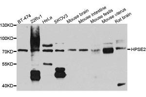 Western blot analysis of extracts of various cell lines, using HPSE2 antibody. (Heparanase 2 抗体  (AA 42-242))