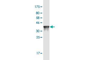 Western Blot detection against Immunogen (36. (TREH 抗体  (AA 25-124))