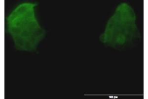 Immunofluorescence of monoclonal antibody to TSPAN8 on 293 cell. (Tspan-8 抗体  (AA 110-205))