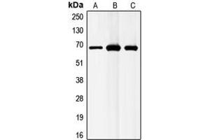 Western blot analysis of GABRB1 expression in MCF7 (A), mouse liver (B), rat liver (C) whole cell lysates. (GABRB1 抗体  (C-Term))