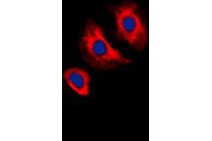 Immunofluorescent analysis of VEGFR2 (pY1175) staining in MCF7 cells. (VEGFR2/CD309 抗体  (C-Term, pTyr1175))