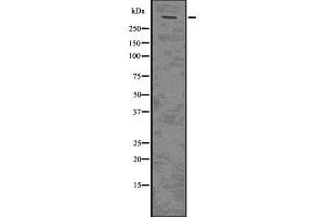 Western blot analysis of PLEC using Jurkat whole  lysates. (PLEC 抗体  (N-Term))