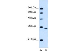 Western Blotting (WB) image for anti-Activin A Receptor, Type IIB (ACVR2B) antibody (ABIN2462828) (ACVR2B 抗体)