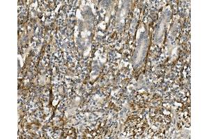 IHC analysis of Sprouty 4/Spry-4/SPRY4 using anti-Sprouty 4/Spry-4/SPRY4 antibody (ABIN7599232).