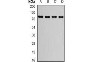 Western blot analysis of GGA2 expression in HepG2 (A), Raji (B), MCF7 (C), mouse brain (D) whole cell lysates. (GGA2 抗体)