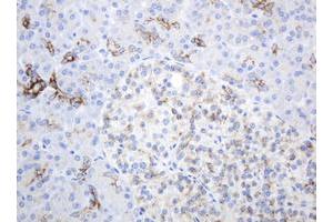 Image no. 3 for anti-ATP-Binding Cassette, Sub-Family B (MDR/TAP), Member 1 (ABCB1) (AA 995-1280) antibody (ABIN1491725)