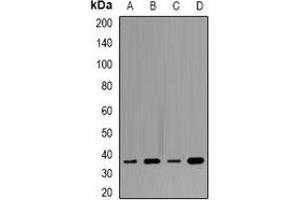 Western blot analysis of Tropomyosin expression in SW480 (A), MCF7 (B), mouse heart (C), mouse brain (D) whole cell lysates. (Tropomyosin 抗体)