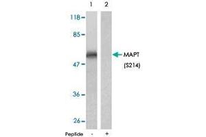 Western blot analysis of extract from mouse brain tissue, using MAPT (phospho S214) polyclonal antibody .