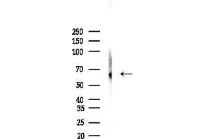 anti-CTP Synthase II (CTPS2) (C-Term) antibody
