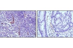 Immunohistochemical analysis of paraffin-embedded human lymph node (left) and colon cancer (right) tissues using eNOS mouse mAb with DAB staining.
