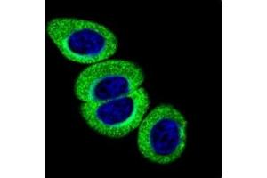 Immunofluorescence (IF) image for anti-Ataxia Telangiectasia Mutated (ATM) (pSer1981) antibody (ABIN3030033)