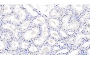 Immunohistochemistry (IHC) image for anti-PSME3 (PSME3) (AA 7-254) antibody (ABIN7441328)