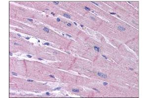 Human Heart: Formalin-Fixed, Paraffin-Embedded (FFPE) (KCNK18 抗体)