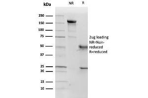 SDS-PAGE Analysis Purified p57 Monoclonal Antibody (KP10). (CDKN1C 抗体)