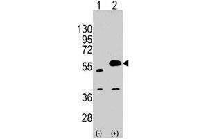 Western blot analysis of SPRED1 polyclonal antibody  (arrow).