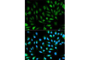 Immunofluorescence analysis of HeLa cell using PARK7 antibody. (PARK7/DJ1 抗体  (AA 1-189))