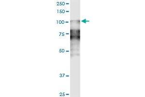 DSC2 monoclonal antibody (M14), clone 1F2. (Desmocollin 2 抗体  (AA 444-534))