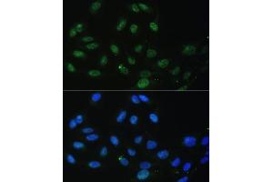 Immunofluorescence analysis of U-2 OS cells using DDX50 antibody (ABIN6129371, ABIN6139509, ABIN6139510 and ABIN6224730) at dilution of 1:100. (DDX50 抗体  (AA 1-135))