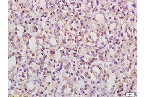 Immunohistochemistry (IHC) image for anti-Activin A Receptor, Type IB (ACVR1B) (AA 51-150) antibody (ABIN761231)