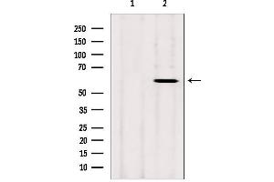 Western Blotting (WB) image for anti-Cytochrome P450, Family 26, Subfamily B, Polypeptide 1 (CYP26B1) (Internal Region) antibody (ABIN6261169)