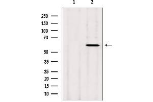 Western blot analysis of extracts from rat heart, using CYP26B1 antibody. (CYP26B1 抗体  (Internal Region))