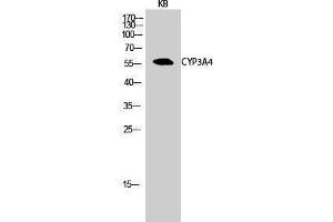 Western Blotting (WB) image for anti-Cytochrome P450, Family 3, Subfamily A, Polypeptide 4 (CYP3A4) (Internal Region) antibody (ABIN6284543)